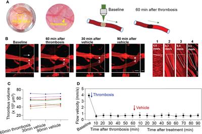 Selective Sphingosine 1-Phosphate Receptor 1 Modulation Augments Thrombolysis of Low-Dose Tissue Plasminogen Activator Following Cerebrovascular Thrombosis